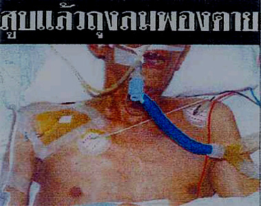Thailand 2005 Health Effects mouth - emphysema, lived experience